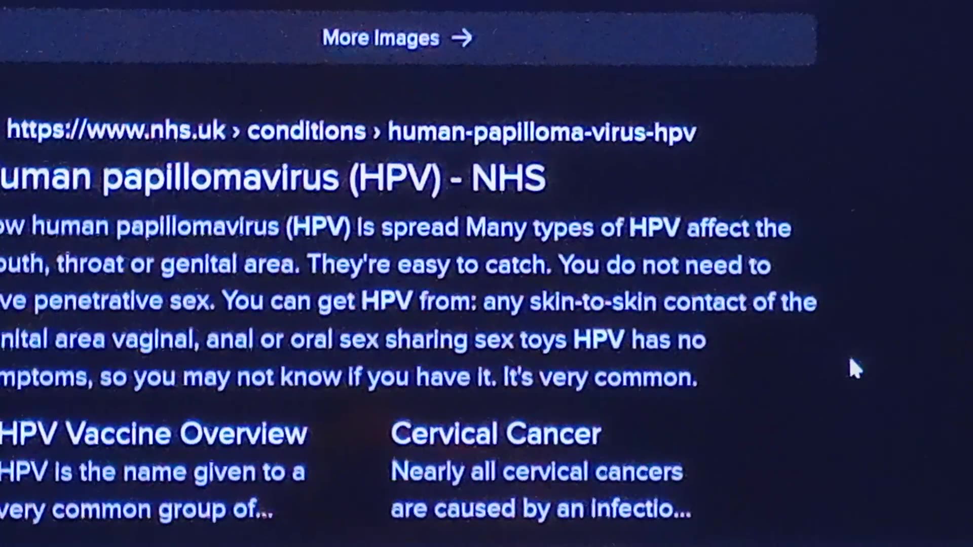 Nhs Hpv Vaccine Sterilisation