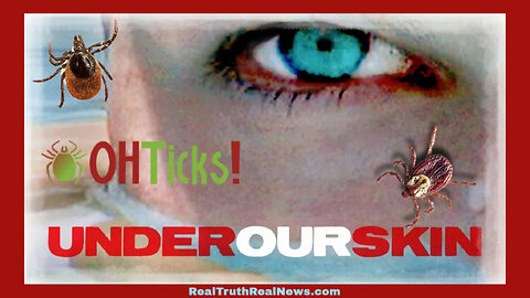 🕷️ 🪲 Documentary: "Under Our Skin ~ The Untold Story of Lyme Disease" Parts 1 and 2 * Info and Treatment Links Below 👇