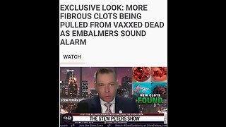 Fibrous Clots Still Being Found In People Post Vaxx
