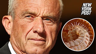 RFK Jr. says doctors found a dead worm in his head after it ate part of his brain