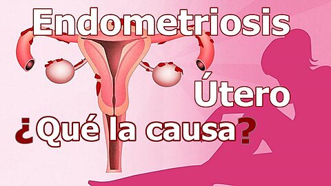 COMBATIR LA ENDOMETRIOSIS Y LAS CAUSAS EMOCIONALES QUE LA PROVOCAN