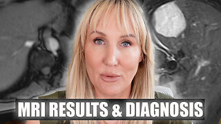 MRI & Endoscopy Results // DIAGNOSIS