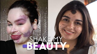 We're Proud Of Our Birthmarks | SHAKE MY BEAUTY