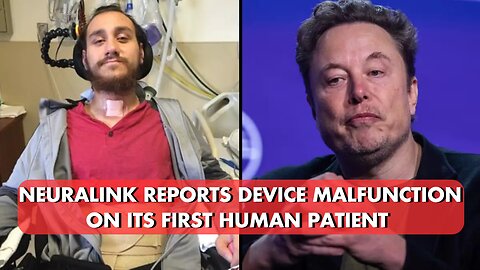 First human brain implant malfunctioned, Neuralink says | News Today | USA |
