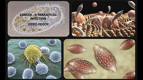 Cancer & all diseases are parasites 🪱🦠