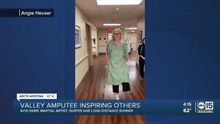 Valley amputee inspiring others