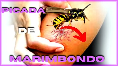 Picada de MARIMBONDO o que fazer para DESINCHAR (16 dicas para tirar a 🐝 dor)