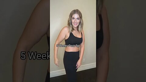 Skin Removal After 100+ Pound Weight Loss