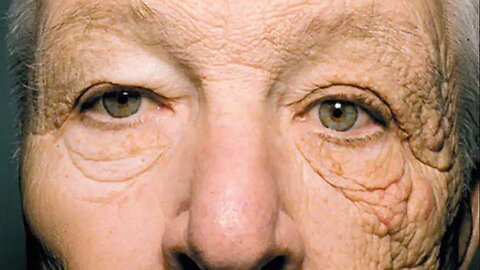 Scientists Discover The Root Cause Of Aging Skin