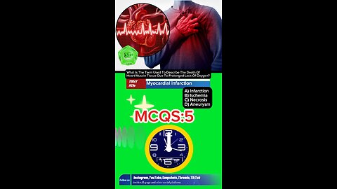 Myocardial infarction mcqs