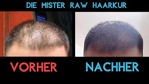 Haare nach 3 Monaten nachgewachsen - Die Mr. Raw Haarkur macht das Unmögliche möglich - Sieh selbst