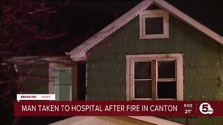 Man severely burned in Canton house fire