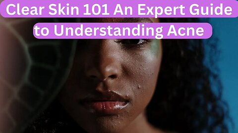 Clear Skin 101 An Expert Guide to Understanding Acne #beauty