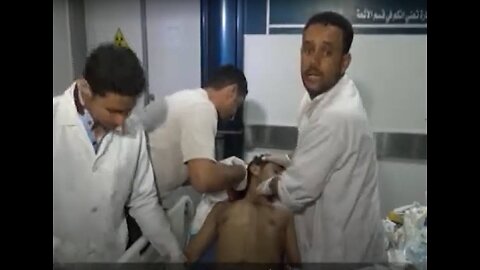 Yemen, Sanaa, Saudi coalition air raid hits 48 hospital