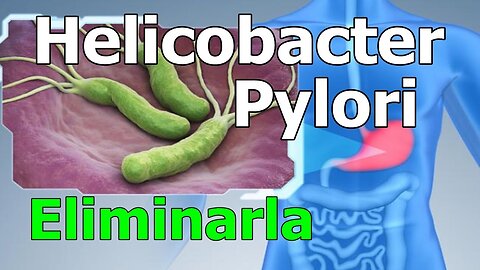 COMO ELIMINAR LA INFECCIÓN POR LA BACTERIA HELICOBACTER PYLORI