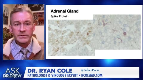 Dr. Ryan Cole Analyzes mRNA in Heart Muscle; Adrenal Gland