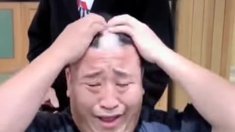 Sneeze and Baldness Do a Close Shave Man Loses More Than Just His Nostrils in a Haircut Mishap!