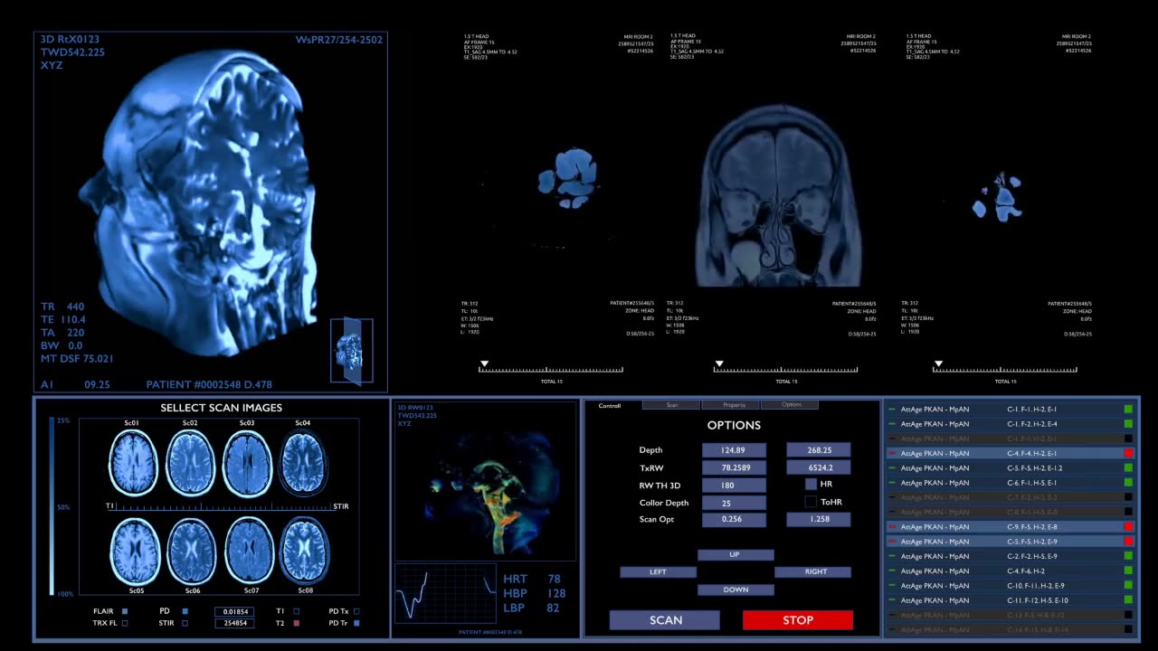 Immune Cells: A Hidden Trigger for Anxiety, Depression, and Alzheimer’s Disease