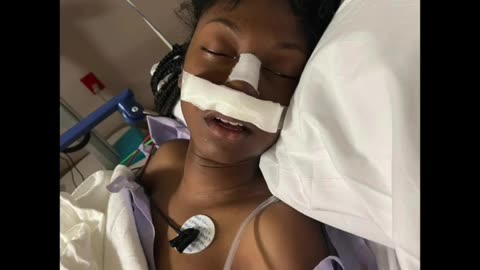 15 Year Old Girl McDonald’s Employee got a Fractured Skull After Man Stomps on Her Head