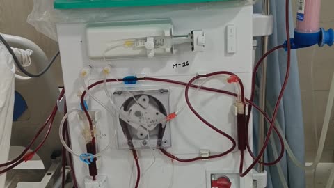 Dialysis machine