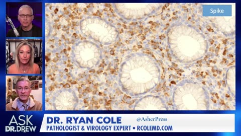 Dr. Ryan Cole: Analysis of Spike Protein in Gastric Tissue, Cancer Cells