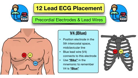 12 Lead ECG Placement MADE EASY [EMT, Nursing, Paramedic] #ecg #nursing