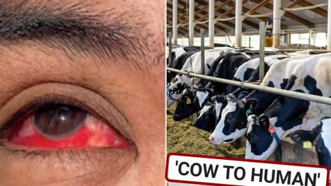 Texas Farm Worker 'Bleeding from Eyeballs' After First Transmission of Bird Flu from Mammal to Human