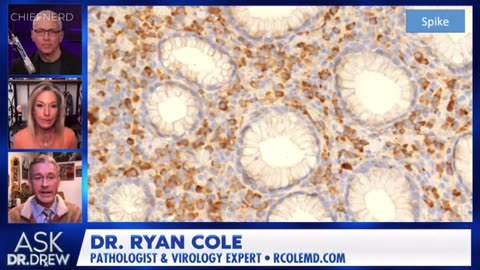 😳 Dr. Ryan Cole Shares Terrifying Biopsy Results Which Could Explain Rise in Cancers