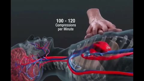 CPR Medical video #3Dmedico