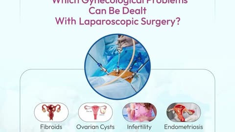 Unsure about open vs. laparoscopic surgery?