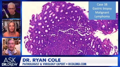 Dr. Ryan Cole Shares Terrifying Biopsy