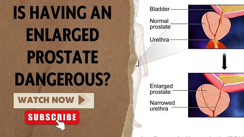 Is Having an Enlarged Prostate Dangerous?