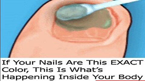If Your Nails Are This EXACT Color, This Is What's Happening Inside Your Body (Do This Now)