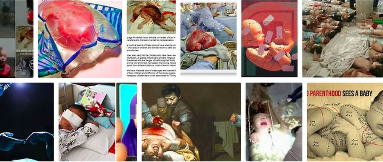https://rumble.com/v2kqeta-u.s.-harvesting-childrens-organs-in-ukraine.-why-western-fascist-mercenarie.html