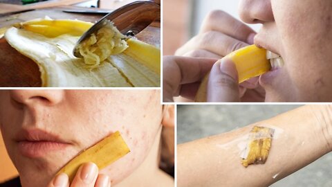 9 Unusual Uses For Banana Peels