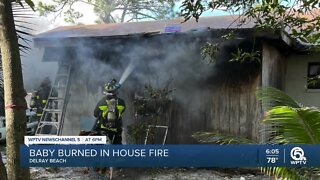 Baby burned in Delray Beach house fire