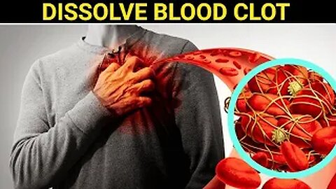12 Foods That Dissolve Blood Clots Naturally (Doctors WON'T Tell You)