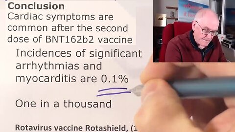 Not So Rare Vaccine Complications