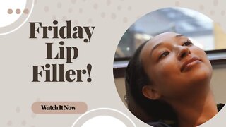 Friday Lip Filler | Barrett Plastic Surgery