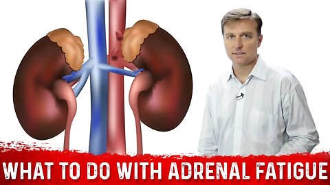 What To Do If You Have Adrenal Fatigue – Dr. Berg Shows Adrenal Fatigue Exercise