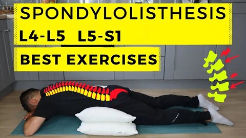 Spondylolisthesis treatment