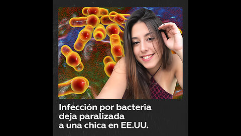 Joven brasileña queda paralizada tras grave infección por bacteria en EE.UU.