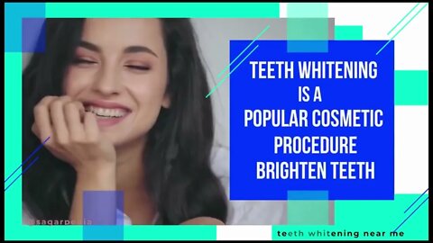 Best Teeth Whitening Kit😎 (2022)😬