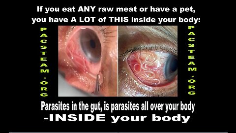 Parasites; NO one wants you to know, you don't want to know -BUT YOU HAVE TO