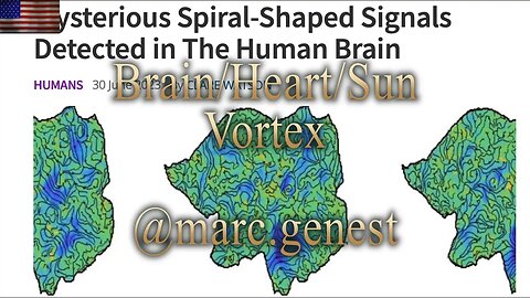 Brain vortex
