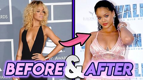 Rihanna | Before & After Transformation ( Thicc & Beautiful )