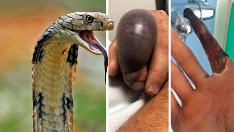 How to Survive a King Cobra Attack