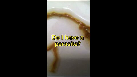 Do I have a parasite? Probably not….