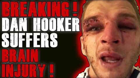Dan Hooker ENDS Colby Covington ! “He’s a f*cking idiot' and 'little rat”