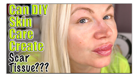 Can DIY Skin Care Create Scar Tissue? | Code Jessica10 saves you Money at All Approved Vendors